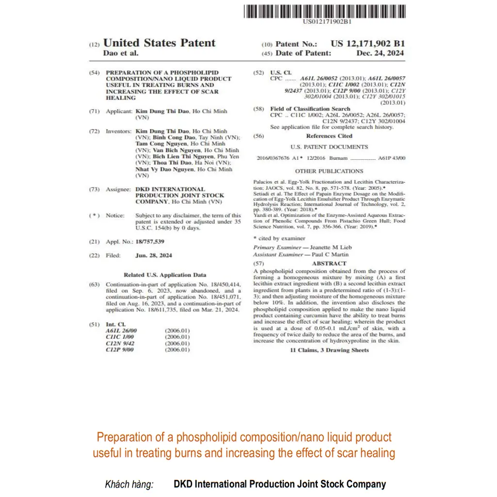 Preparation of a phospholipid composition/nano liquid product useful in treating burns and increasing the effect of scar healing